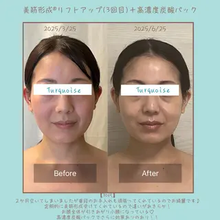 フェイシャルエステ Turquoiseのエステ・リラクイメージ