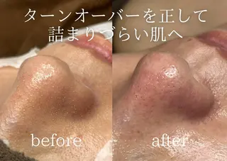 Peerless所属・chi kaのエステ・リラクイメージ