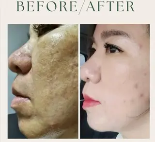 小顔/たるみ/黒ずみ除去専門サロン/SONA 大和西大寺店所属・【小顔専門看護師 サロンSONA】のエステ・リラクイメージ