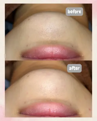 beauty salon  SUKOBI所属・ﾋﾞｭｰﾃｨｻﾛﾝ SUKOBIのエステ・リラクイメージ