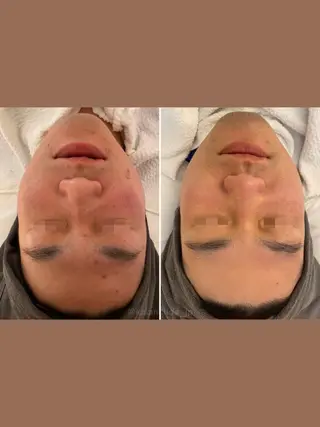 肌質改善 KALANCHOEのエステ・リラクイメージ