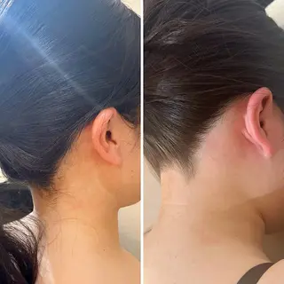 うなじ脱毛/美肌脱毛 LABELのエステ・リラクイメージ