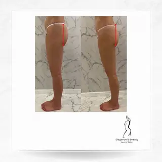 Elegance&Beauty バストアップ専門店所属・Elegance &Beauty 船橋のエステ・リラクイメージ