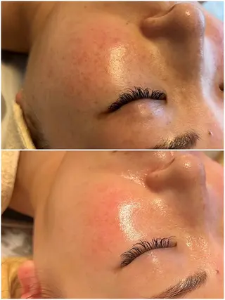 痩身・フェイシャル/if  byOrabriller所属・if byOrab riller【ｲﾌ】のその他イメージ