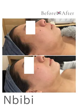 韓国🇰🇷価格 サロン_Nbibiのエステ・リラクイメージ