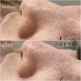 マツエク・マツパ omii salon 草津店:yurinaのマツエク・マツパデザイン