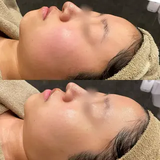 Re:Belle所属・Re:Belle 久留米 : 中島のエステ・リラクイメージ