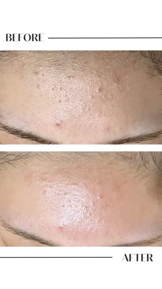 フェイシャル/脱毛 ジョアアンジェ景山のエステ・リラクイメージ