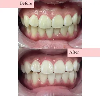 ホワイトニングサロン nybeのその他イメージ