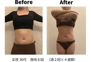 メンズ RemoreBeauty所属・Nakano Kazunariのエステ・リラクイメージ