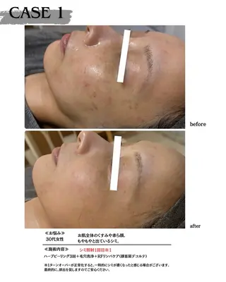 素肌育成・シミケア専門サロン美潤-miulu-所属・【医療提携サロン】 【シミケア専門】のエステ・リラクイメージ