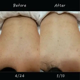 デアイム東広島所属・中井 小春のエステ・リラクイメージ