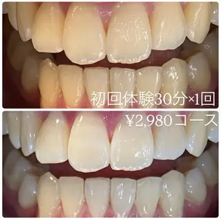 PLATINUM Beauty 横浜店所属・ホワイトニングルーム 横浜店のその他イメージ