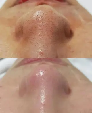 U・mi ユキのマツエク・マツパデザイン