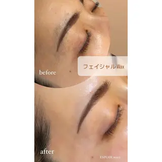 ワックス脱毛🌈 ESPOIRnocoのエステ・リラクイメージ