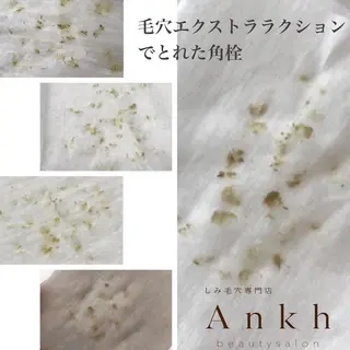 【しみ毛穴専門店】beautysalon Ankh所属・しみ毛穴専門店 Ankh 平田のエステ・リラクイメージ