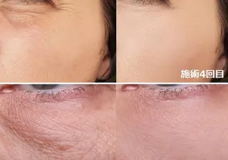 全身脱毛＆VIO脱毛 紹介率№1♪リナ♪のエステ・リラクイメージ