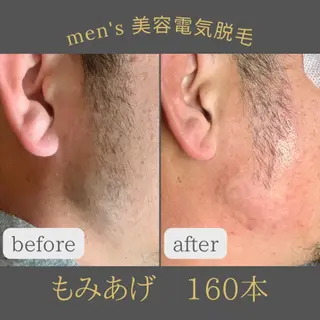 メンズ 中庄駅前エステ BRILLAR小豆のヘアスタイル