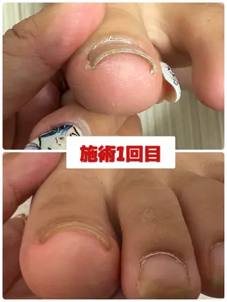 ネイル nail salon -TOIRO-所属・-TOIRO- Eriのネイルデザイン