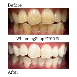 ホワイトニング ショップ吉祥寺店のエステ・リラクイメージ