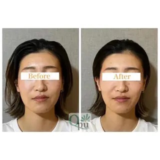 Qpu(キュープ)下北沢店所属・鮎川 さゆりのエステ・リラクイメージ