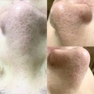 韓国式３D毛穴洗浄＆ 脱毛vive京橋のエステ・リラクイメージ