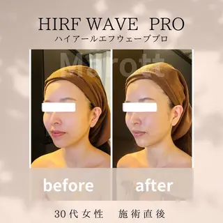 小顔サロン Marottのエステ・リラクイメージ