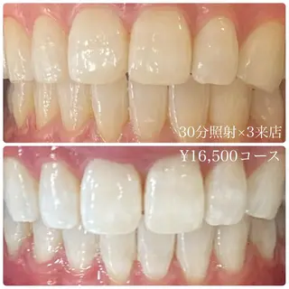 PLATINUM Beauty 横浜店所属・ホワイトニングルーム 横浜店のその他イメージ