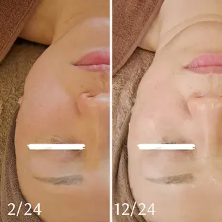 鍼灸サロンmiyabi所属・美容鍼×エステ 鍼灸 サロンmiyabiのエステ・リラクイメージ