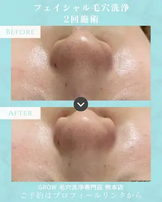 韓国式フェイシャル エステGROW熊本店のエステ・リラクイメージ