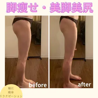 bellissimo 【ベリッシモ】所属・ちひろ　痩身/ハーブ bellissimoのエステ・リラクイメージ