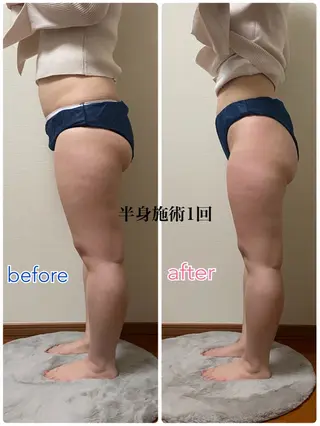 ACORAL痩身 NAZUKIのエステ・リラクイメージ