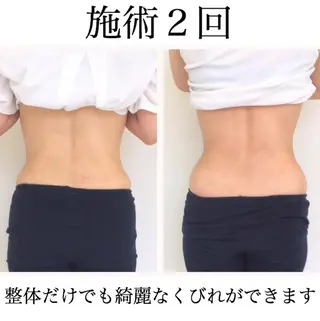 小顔モニター 募集のエステ・リラクイメージ