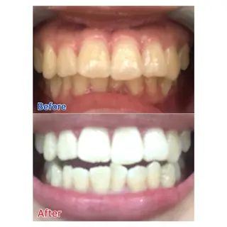 MBEAUTYSALON 千葉店・京成大久保所属・Melty 輝のその他イメージ