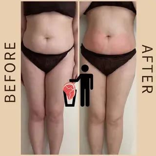 脂肪冷却・脱毛・フェイシャルサロンcoconoix [ｺｺﾉﾜ]所属・脂肪冷却・脱毛サロン coconoix のエステ・リラクイメージ