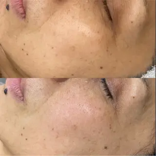 CE salon Euluna所属・CE salon Eulunaのエステ・リラクイメージ