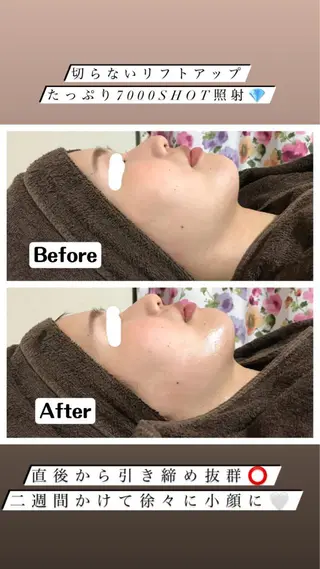 カラー パーマ ヘアアレンジ メンズ キッズ ネイル マツエク・マツパ アイブロウ Chloe-クロエ- 脱毛/フェイシャルのエステ・リラクイメージ