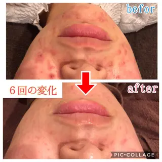 ミディアム カラー パーマ ヘアアレンジ メンズ キッズ ネイル マツエク・マツパ 四つ星サロン🎖 腸＆ニキビケアに特化のエステ・リラクイメージ