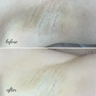 メンズ be.me maiのエステ・リラクイメージ