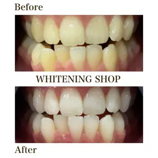 ホワイトニングショップ安城店所属・ホワイトニング ショップ安城店のその他イメージ