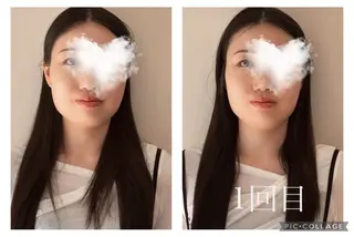 肩こり・腰痛改善専門 1万人以上施術の碧人のエステ・リラクイメージ