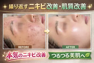 フェイシャルサロン Min-aのエステ・リラクイメージ