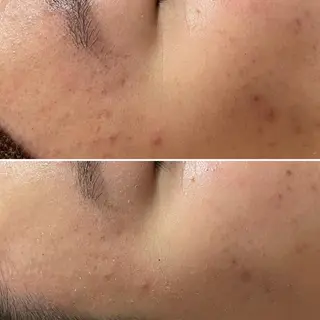 アロマ•ピーリング SalonYokoのその他イメージ