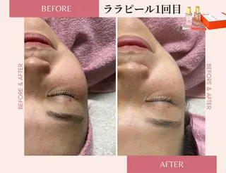 医療提携サロン&パーソナルカラー/骨格/顔タイプ診断 La chic所属・パーソナルカラー &エステ SHIHOのその他イメージ