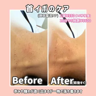 バストアップ専門/ ボディケア/小顔のエステ・リラクイメージ