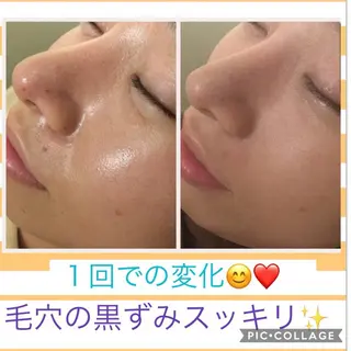 ミディアム パーマ ヘアアレンジ メンズ キッズ ネイル マツエク・マツパ ニキビ・肌質改善専門 ♡人生が変わるサロンのエステ・リラクイメージ