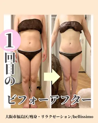 bellissimo 【ベリッシモ】所属・ちひろ　痩身/ハーブ bellissimoのエステ・リラクイメージ