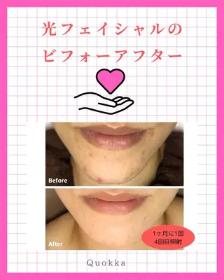 Quokka ✴︎ あま市甚目寺のエステ・リラクイメージ