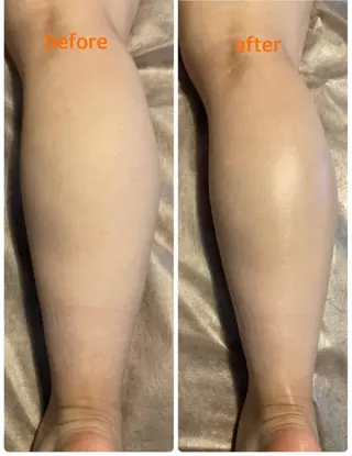 bellissimo 【ベリッシモ】所属・ちひろ　痩身/ハーブ bellissimoのエステ・リラクイメージ