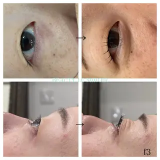 マツエク・マツパ ビューティー ミロワールのエステ・リラクイメージ